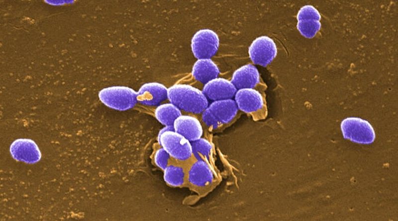 las-esporas-de-hongo-y-otros-microorganismos-son-candidatas-a-sobrevivir-en-la-superficie-de-marte,-segun-la-nasa
